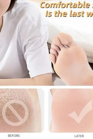 Moisturizing Anti-Crack Silicone Socks for heal cracks and pain relief